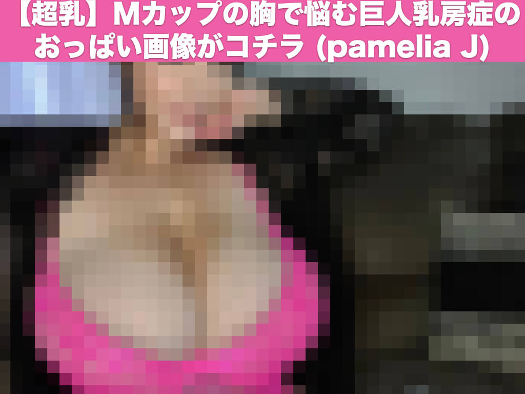 【超乳】Mカップの胸で悩む巨人乳房症のおっぱい画像がコチラ (pamelia J)